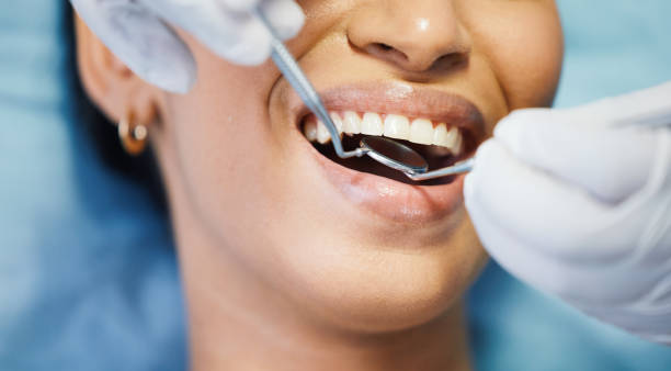 Best Urgent Tooth Repair  in Country Clu, FL